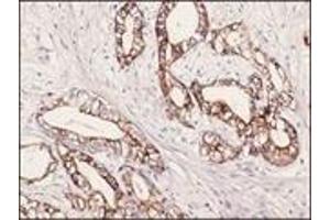 Immunohistochemistry (IHC) image for anti-Keratin 7 (KRT7) (C-Term) antibody (ABIN870435) (Cytokeratin 7 Antikörper  (C-Term))