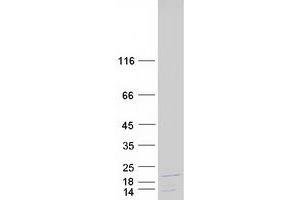 Validation with Western Blot (C1D Protein (Transcript Variant 2) (Myc-DYKDDDDK Tag))