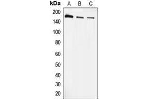 Western blot analysis of EEA1 expression in A431 (A), HeLa (B), THP1 (C) whole cell lysates. (EEA1 Antikörper  (N-Term))