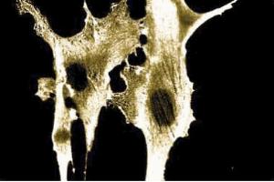 anti-Annexin A2 (ANXA2) (AA 123-328) antibody