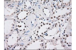 Immunohistochemical staining of paraffin-embedded endometrium tissue using anti-FHmouse monoclonal antibody. (FH Antikörper)