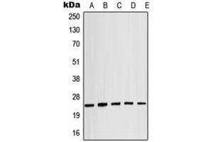 Western blot analysis of Alpha-crystallin B (pS19) expression in MCF7 (A), mouse spleen (B), mouse eye (C), rat liver (D), rat eye (E) whole cell lysates.