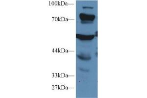 Western Blot; Sample: Mouse Liver lysate; Primary Ab: 1µg/ml Rabbit Anti-Human PCCa Antibody Second Ab: 0. (PCCA Antikörper  (AA 580-728))