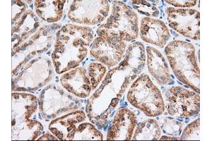 Immunohistochemical staining of paraffin-embedded Human liver tissue using anti-RAB17 mouse monoclonal antibody. (RAB17 Antikörper)