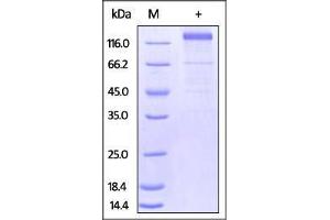 HCMV Glycoprotein B (gB), Fc Tag on SDS-PAGE under reducing (R) condition.