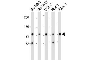 All lanes : Anti-PCDH20 Antibody (Center) at 1:2000 dilution Lane 1: SK-BR-3 whole cell lysate Lane 2: SH-SY5Y whole cell lysate Lane 3: MCF-7 whole cell lysate Lane 4: HL-60 whole cell lysate Lane 5: Rat brain whole cell lysate Lysates/proteins at 20 μg per lane. (PCDH20 Antikörper  (AA 445-472))
