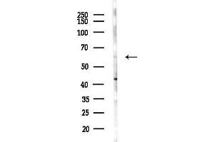 Western blot analysis of lysates from Mouse liver, using Phospho-SENP2 (Thr368) Antibody at 1/1000 dilution.