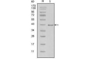 Western Blot showing LAMB1 antibody used against truncated LAMB1-His recombinant protein (1). (Laminin Antikörper  (AA 31-270))