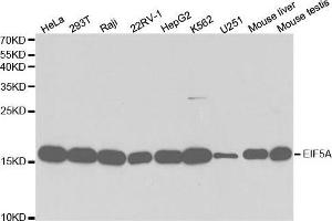 EIF5A Antikörper  (AA 1-154)