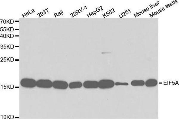 EIF5A Antikörper  (AA 1-154)