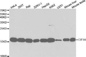 Western blot analysis of extracts of various cell lines, using EIF5A antibody. (EIF5A Antikörper  (AA 1-154))