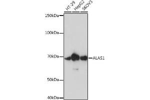 Western blot analysis of extracts of various cell lines, using  Rabbit mAb (ABIN7265571) at 1:1000 dilution. (ALAS1 Antikörper)