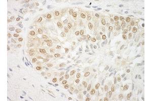 anti-AT Rich Interactive Domain 3B (BRIGHT-Like) (ARID3B) (AA 100-150) antibody