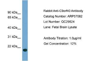 WB Suggested Anti-C9orf40  Antibody Titration: 0. (C9orf40 Antikörper  (Middle Region))