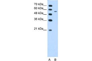 WB Suggested Anti-CHST7 Antibody Titration:  1. (CHST7 Antikörper  (Middle Region))