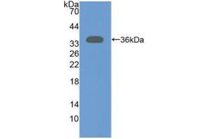 Western blot analysis of recombinant Rat NT5C3. (NT5C3 Antikörper  (AA 8-289))