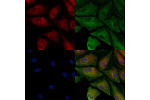 ABIN6260104 and ABIN6278139 staining  cells by IF/ICC. (ATG4A Antikörper  (N-Term))