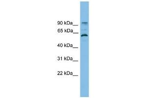 ANKRD5 antibody used at 1 ug/ml to detect target protein. (ANKRD5 Antikörper  (N-Term))