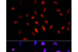 Immunofluorescence analysis of U2OS cells using COMMD1 Polyclonal Antibody at dilution of 1:100. (COMMD1 Antikörper)