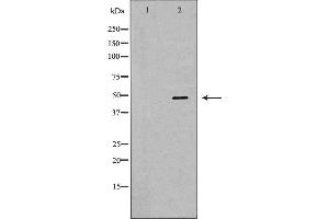 Western Blotting (WB) image for anti-SWI/SNF Related, Matrix Associated, Actin Dependent Regulator of Chromatin, Subfamily E, Member 1 (SMARCE1) (C-Term) antibody (ABIN6265182)