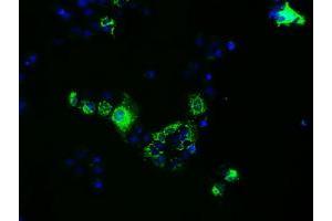 Anti-FAHD2A mouse monoclonal antibody (ABIN2453016) immunofluorescent staining of COS7 cells transiently transfected by pCMV6-ENTRY FAHD2A (RC211128). (FAHD2A Antikörper)