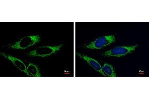 ICC/IF Image Adenylate kinase 3 antibody [N1C3] detects Adenylate kinase 3 protein at mitochondria by immunofluorescent analysis.