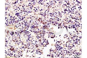 Formalin-fixed and paraffin embedded mouse embryo tissue labeled with Rabbit Anti-ERK1 (Thr203/Tyr205) + ERK2 (Thr183/Tyr185) Polyclonal Antibody, Unconjugated (ABIN687727) at 1:200 followed by conjugation to the secondary antibody and DAB staining (ERK1/2 Antikörper  (pThr183, pTyr185))