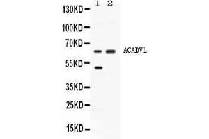 Western blot analysis of ACADVL expression in rat liver extract ( Lane 1) and HELA whole cell lysates ( Lane 2). (ACADVL Antikörper  (C-Term))