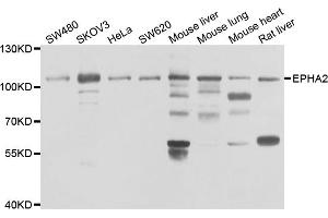Western blot analysis of extracts of various cell lines, using EPHA2 antibody. (EPH Receptor A2 Antikörper)