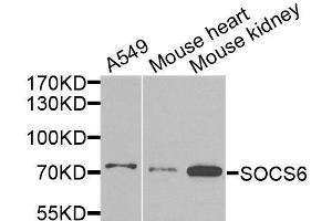 Western blot analysis of extracts of various cell lines, using SOCS6 antibody (ABIN6003665) at 1/1000 dilution. (SOCS6 Antikörper)