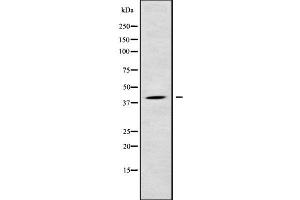 LPGAT1 Antikörper  (Internal Region)