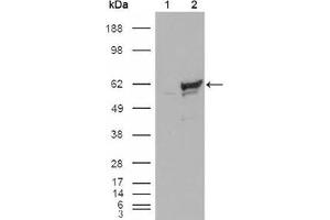 Western blot analysis using CHK1 mouse mAb against HEK293T cells transfected with the pCMV6-ENTRY control (1) and pCMV6-ENTRY CHK1 cDNA (2). (CHEK1 Antikörper)