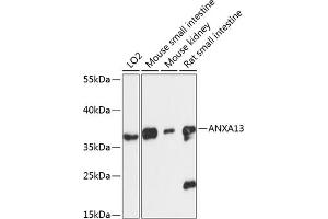 Western blot analysis of extracts of various cell lines, using  antibody (ABIN6127437, ABIN6136922, ABIN6136923 and ABIN6217829) at 1:3000 dilution. (Annexin A13 Antikörper  (AA 1-316))