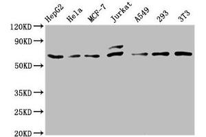 Western Blot Positive WB detected in: HepG2 whole cell lysate, Hela whole cell lysate, MCF-7 whole cell lysate, Jurkat whole cell lysate, A549 whole cell lysate, 293 whole cell lysate, NIH/3T3 whole cell lysate All lanes: c-FOS antibody at 0. (Rekombinanter c-FOS Antikörper)
