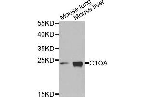 Western blot analysis of extracts of mouse lung and mouse liver cells, using C1QA antibody. (C1QA Antikörper)