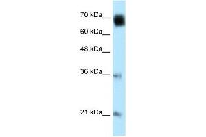 GLMN antibody used at 1 ug/ml to detect target protein. (GLMN Antikörper  (Middle Region))
