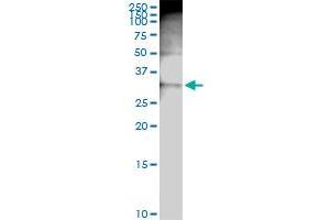 Immunoprecipitation (IP) image for anti-Protein Kinase, Interferon-Inducible Double Stranded RNA Dependent Activator (PRKRA) (AA 1-313) antibody (ABIN522050)
