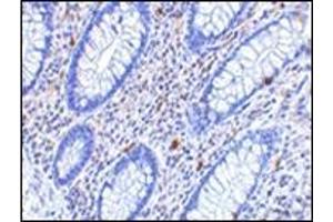 Immunohistochemistry of KAI1 in human colon tissue with this product at 2.