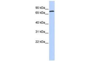 Image no. 1 for anti-Zinc Finger Protein 613 (ZNF613) (AA 35-84) antibody (ABIN6742887)