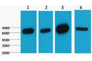 Western Blotting (WB) image for anti-Lamin B1 (LMNB1) antibody (ABIN3181108) (Lamin B1 Antikörper)