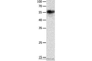 Western blot analysis of Hela cell, using CHRNA3 Polyclonal Antibody at dilution of 1:600 (CHRNA3 Antikörper)