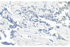 anti-Kinesin Family Member 14 (KIF14) (C-Term) antibody