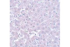 Immunohistochemical staining of rat liver tissue with CALHM1 polyclonal antibody  at 5 ug/mL dilution.