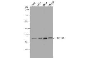WB Image UGT1A6 antibody detects UGT1A6 protein by western blot analysis.