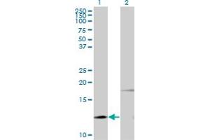Western Blotting (WB) image for anti-Parathyroid Hormone (PTH) antibody (ABIN793030) (PTH Antikörper)