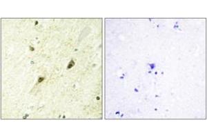 Immunohistochemistry analysis of paraffin-embedded human brain tissue, using GLI-3 Antibody.