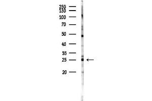 Western blot analysis of lysates from Rat testis, using GSTP1 Antibody at 1/1000 dilution.