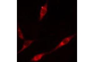 ABIN6276587 staining  A549 cells by IF/ICC. (PML Antikörper  (N-Term))
