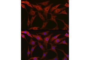 Immunofluorescence analysis of NIH-3T3 cells using β-Tubulin Rabbit pAb (ABIN3020552, ABIN3020553 and ABIN3020554) at dilution of 1:100 (40x lens). (TUBB Antikörper  (AA 40-260))