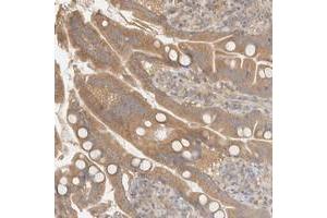Immunohistochemical staining of human small intestine with FAM167A polyclonal antibody  shows moderate cytoplasmic positivity in glandular cells. (FAM167A Antikörper)